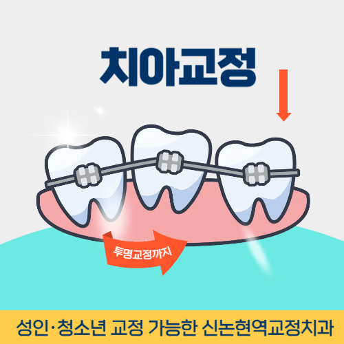 상주치과 상주시 치과 치아교정