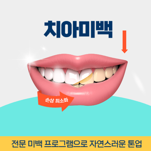 상주치과 상주시 치과 치아미백