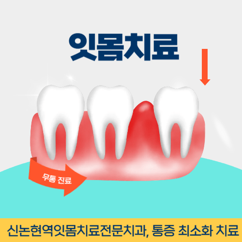 상주치과 상주시 치과 잇몸치료